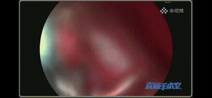 1647478544428312IzJy.gif 7.gif